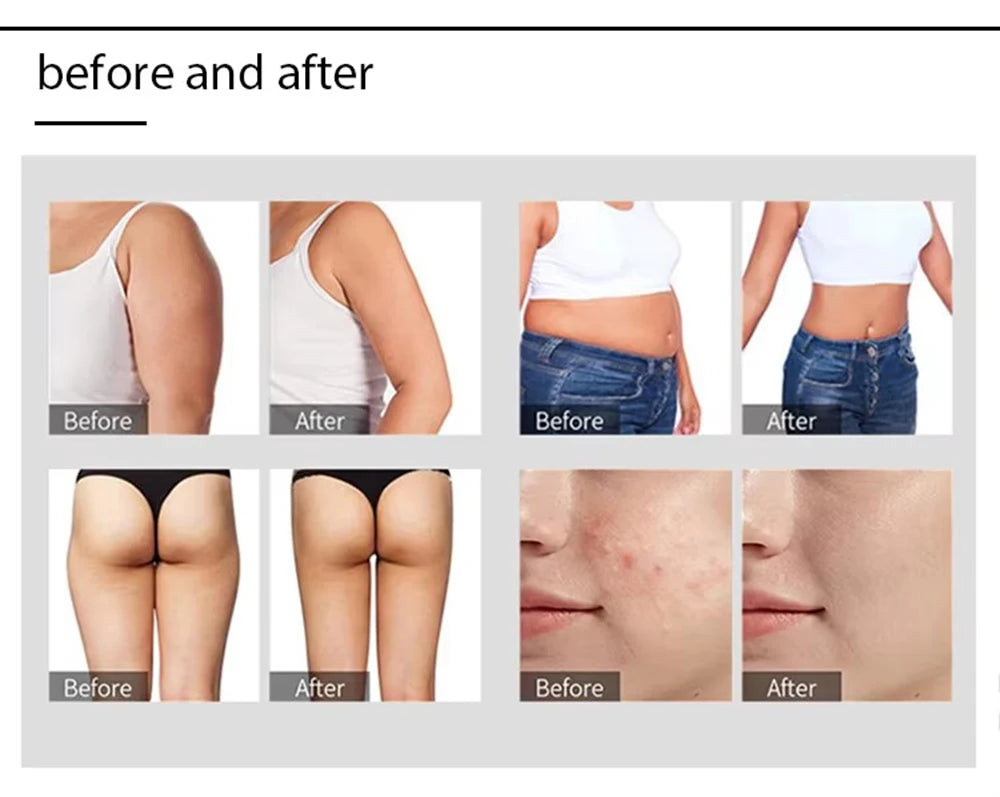 Machine de Cavitation ultrasonique 40K, radiofréquence corporal, Lifting du visage, amincissante, beauté, Massage de la peau, perte de poids